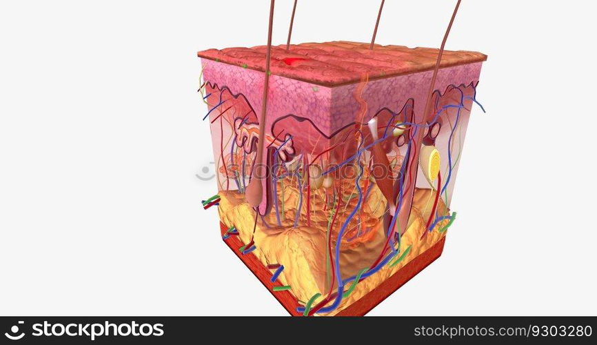 Contact Dermatitis in Skin Tissue 3D rendering. Contact Dermatitis in Skin Tissue