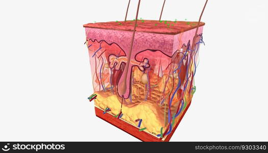 Contact Dermatitis in Skin Tissue 3D rendering. Contact Dermatitis in Skin Tissue