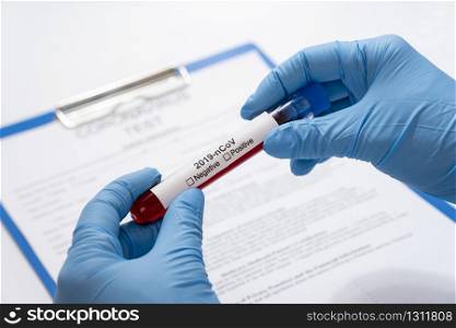 corona virus coronavirus rapid test