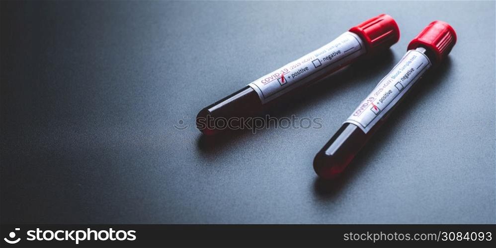 Coronavirus COVID-19 blood test in test tube, science laboratory for the development of vaccines and antiviral drugs, and human virus testing