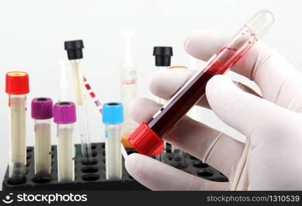 Coronavirus disease (COVID-19) research. Blood test. Regular blood testing is one of the most important ways to keep track of your overall physical well-being.