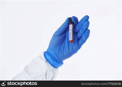 Coronavirus, Doctor holding positive covid-19 virus Blood S&le test tube. Wearing biohazard epidemic Protective mask, suit and gloves against white background