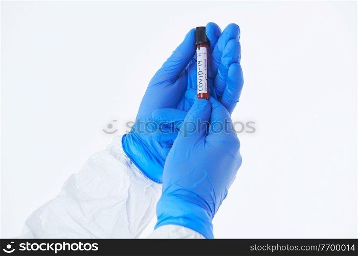 Coronavirus, Doctor holding positive covid-19 virus Blood Sample test tube. Wearing biohazard epidemic Protective mask, suit and gloves against white background