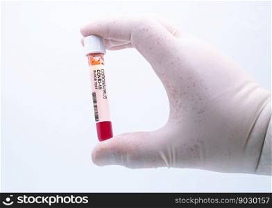 Coronavirus positive blood test. Coronavirus covid-19 outbreaking. Epidemic virus Respiratory Syndrome. Pharmaceutical   genetics Research Centre.