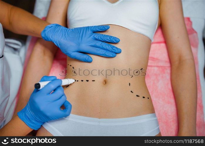 Cosmetician applies markers to female patient body, botox injections preparation. Rejuvenation procedure in beautician salon. Cosmetic surgery against wrinkles