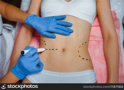 Cosmetician applies markers to female patient body, botox injections preparation. Rejuvenation procedure in beautician salon. Cosmetic surgery against wrinkles