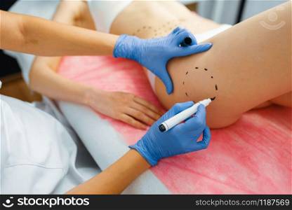 Cosmetician with marker puts dotted lines on female patient body, botox injections preparation. Rejuvenation procedure in beautician salon. Cosmetic surgery against wrinkles and aging. Cosmetician with marker puts dotted lines on body