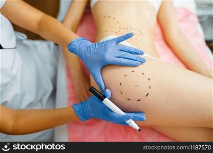 Cosmetician with marker puts dotted lines on female patient body, botox injections preparation. Rejuvenation procedure in beautician salon. Cosmetic surgery against wrinkles and aging