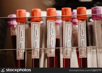 COVID-19 blood test in test-tube, sample of blood testing for diagnosis new Corona virus infection(novel corona virus disease 2019)