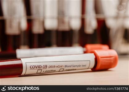 COVID-19 test and laboratory sample of blood testing for diagnosis new Corona virus infection(novel corona virus disease 2019)from Wuhan with laboratory background. Pandemic infectious concept