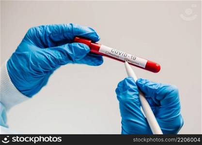 Covid-19 text. A hands of doctor, nurse, scientist writes with a pen and confirms the negative result, hold a test tube with biological s&le. Coronavirus. Blood is dont infected. New cases of cure.