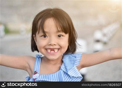 Cute little girl smile with her broken tooth. Close up of child front tooth broken.