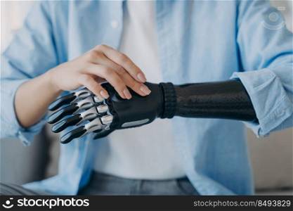 Cyber hand of female amputee. Disabled woman is changing settings of bionic arm. Electronic sensor hand has processor and buttons. High tech carbon robotic prosthesis. Medical technology and science.. Cyber hand of female amputee. Disabled woman is changing settings of robotic prosthesis.
