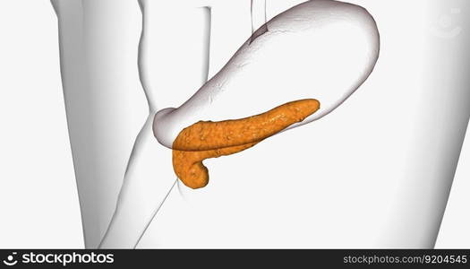 Cystic fibrosis is a genetic disorder characterized by thick mucus production. 3D rendering. Cystic fibrosis is a genetic disorder characterized by thick mucus production.