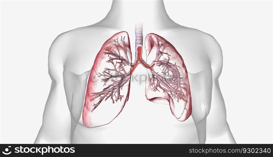 Cystic fibrosis is a genetically inherited disease that affects secretory cells throughout the body. 3D rendering. Cystic fibrosis is a genetically inherited disease that affects secretory cells throughout the body.
