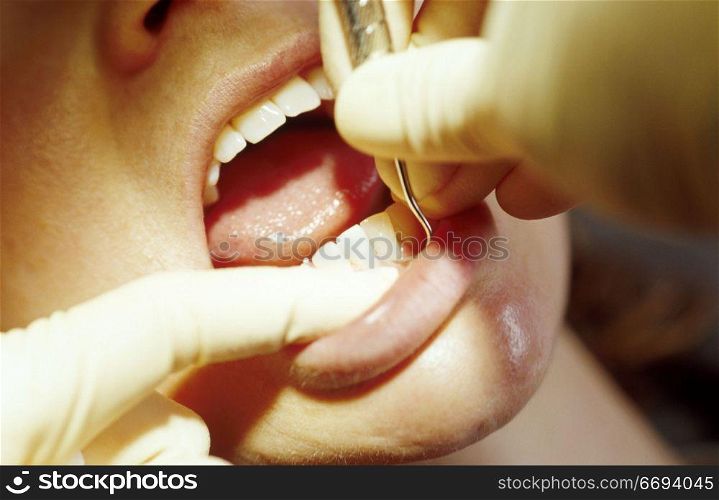 Dental Appointment