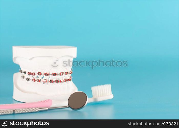 Dental braces model on blue background.