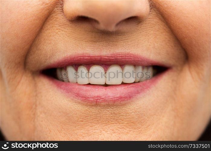 dental care and hygiene people concept - close up of senior woman smiling mouth and teeth. close up of senior woman smiling mouth and teeth