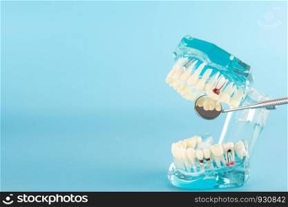Dental implant model on blue background.