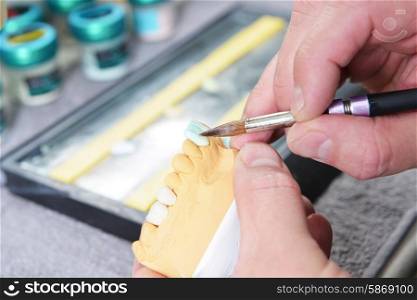 dental technician working on false teeth. table with dental tools.&#xA;