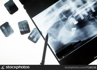 Dental x ray film for dental care concept