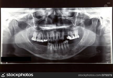 Dental x ray film for dental care concept