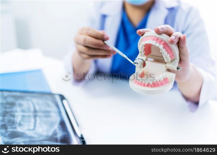 Dentist at dental clinic White healthy tooth with Dental model in oral surgeons discussing jaw x-ray on tabletmedicine healthcare oral surgery concept