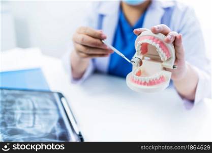 Dentist at dental clinic White healthy tooth with Dental model in oral surgeons discussing jaw x-ray on tabletmedicine healthcare oral surgery concept