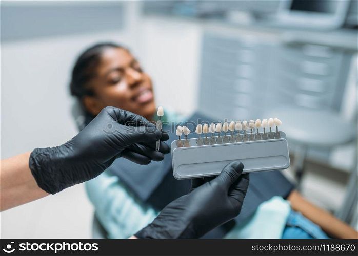 Dentist choosing the shade of teeth, female patient in dental clinic. Woman in dentistry cabinet, stomatology, teeth care. Dentist choosing the shade of teeth, dental clinic
