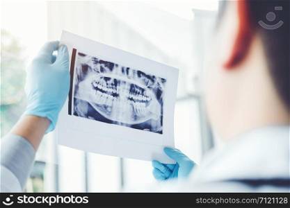 Dentist consulting with patient presenting results on Dental x-ray film About the problem of the patient