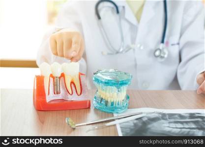 Dentist with dental implant model.