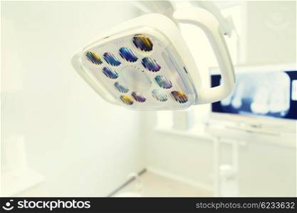 dentistry, medicine, medical equipment and stomatology concept - close up of lamp at dental clinic office