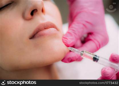 Dermal Filler Injection. A beautiful woman receives dermal filler injections for the chin.. Dermal Filler Injection for Chin