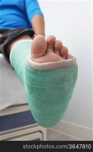 Detail of boy&acute;s leg in plaster cast