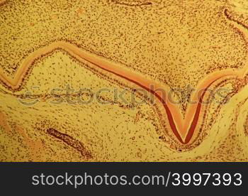 Developing tooth
