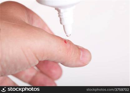 disinfect the scratch by rubbing in alcohol cuts on the hand