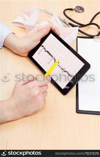 doctor checks patient electrocardiogram on tablet pc