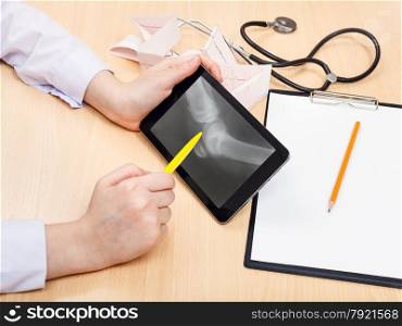 doctor examines X-ray picture of human knee joint on tablet pc