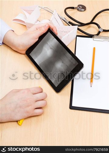 doctor examines X-ray picture of human knee joint on tablet pc