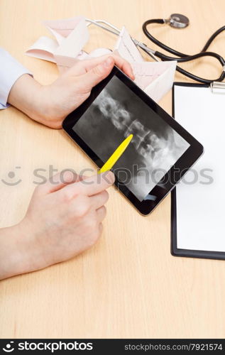 doctor examines X-ray picture of human spinal column on tablet pc