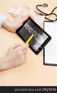 doctor examines X-ray picture of human spinal column on tablet pc