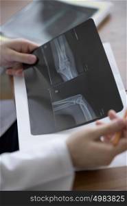 Doctor examining an elbow x-ray. Medicine and healthcare