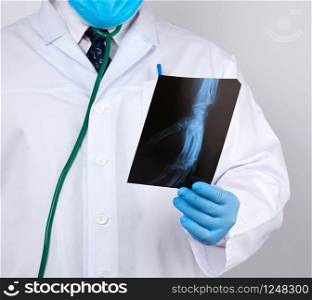 doctor in a white coat and blue latex gloves holds an x-ray of a man&rsquo;s hand and conducts a visual examination, white background