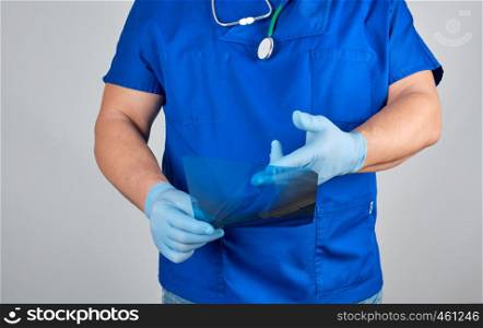 doctor in blue uniform and sterile latex gloves holds and examines X-ray of leg bone, gray background