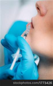 Doctor injecting dermal filler into woman&rsquo;s lips. Dermal Filler for Lips