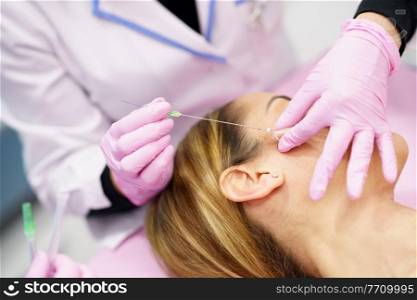Doctor injecting PDO suture treatment threads into the face of a middle-aged woman.. Doctor injecting PDO suture treatment threads into the face of a woman.