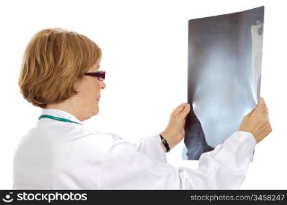 Doctor looking to x-ray picture over white background