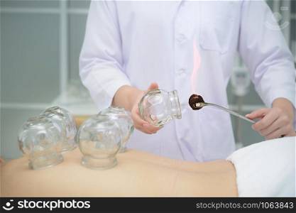 Doctor preparing cups to place on the patient&rsquo;s back for cupping treatment,traditional chinese medicine treatment.