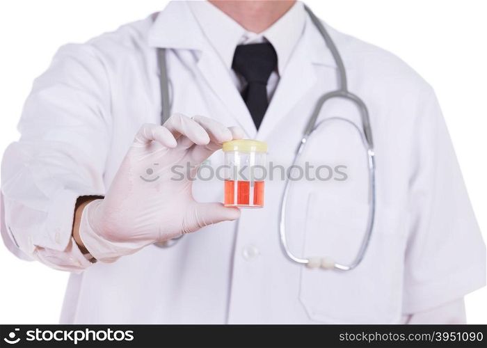 doctor&rsquo;s hand holding a bottle of bloody urine sample isolated on white background