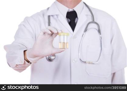 doctor&rsquo;s hand holding a bottle of urine sample